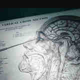 Лоботомия. Позорная медицина