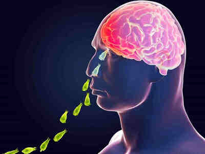 Это происходит, когда амебы попадают в носовую полость человека, откуда паразит попадает в обонятельный нерв и через него — в головной мозг, где распространяется по всем его отделам.