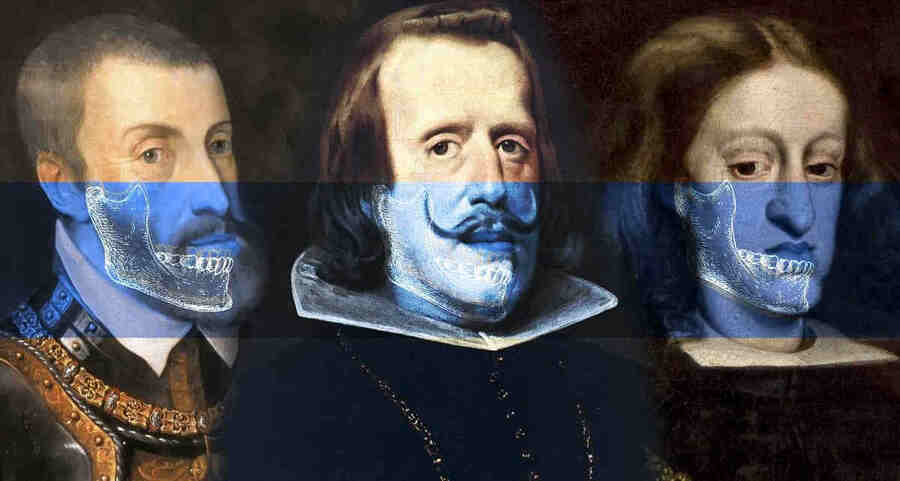 Это включало аномалии в челюсти и лице, которые могли сказываться на здоровье и внешности.