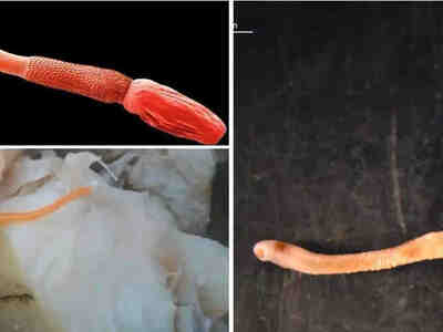 Примеры скребней