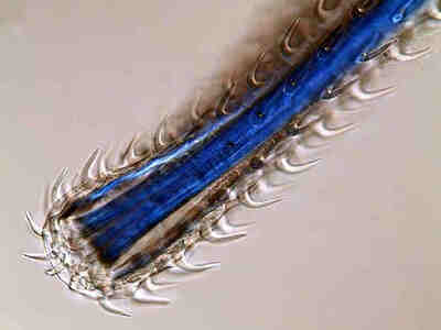 Крючья помогают прикрепиться к стенкам кишечника хозяина