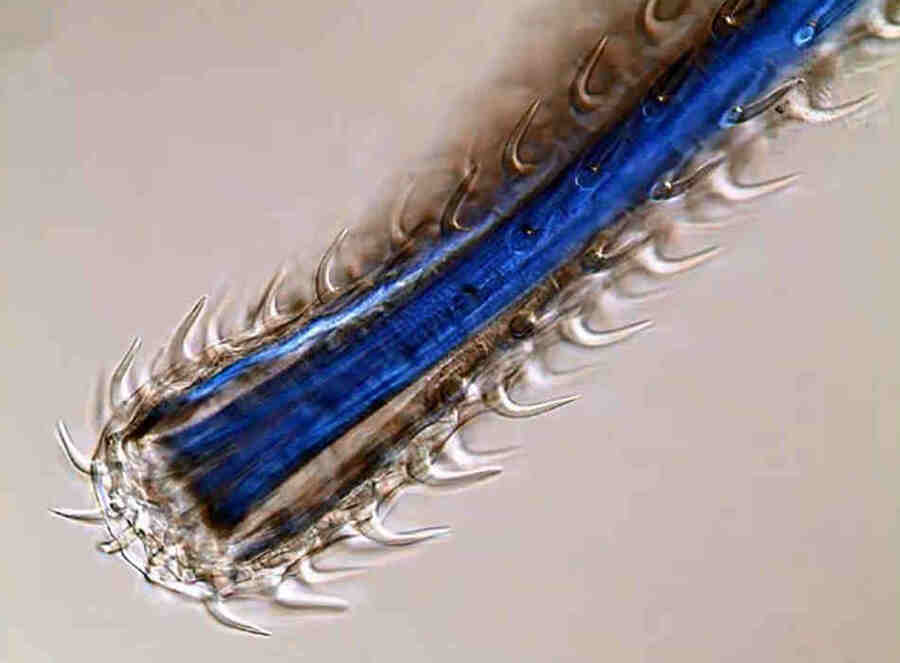 Крючья помогают прикрепиться к стенкам кишечника хозяина